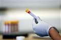 WHO urges all nations to work together for Covid-19 vaccine