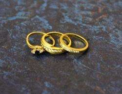 Arlene Fraser's rings.