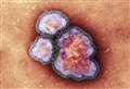 Two further cases of measles confirmed in Scotland